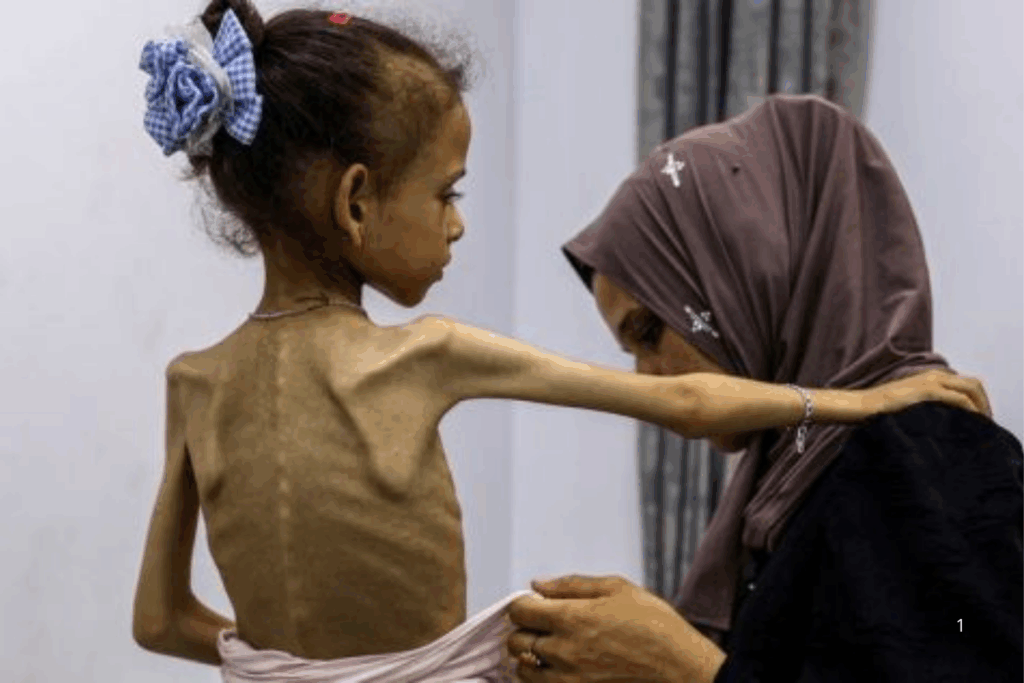 DENÚNCIA: ONGs Israelenses Acusam o Governo Netanyahu de Genocídio em Gaza Foto: OMS/ONU