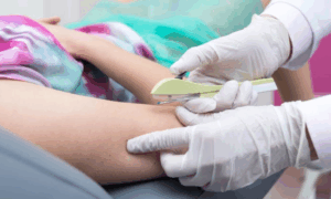 PRIORIDADE: Implante Contraceptivo Eficaz e Duradouro Será Oferecido no SUS