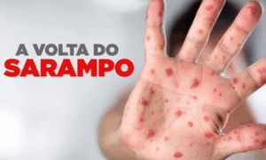 EMERGÊNCIA: Sarampo Avança na Bolívia e Acre Reforça Vacinação na Fronteira Notícias do Acre e6Barra8