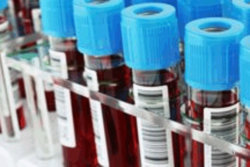 EXAME: Biópsia Líquida a Revolução no Tratamento Oncológico com Exame de Sangue