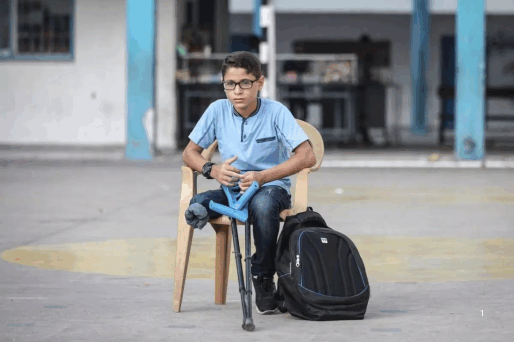 URGENTE: Guerra em Gaza Deixa Milhares de Crianças com Deficiências por Consequência do Conflito