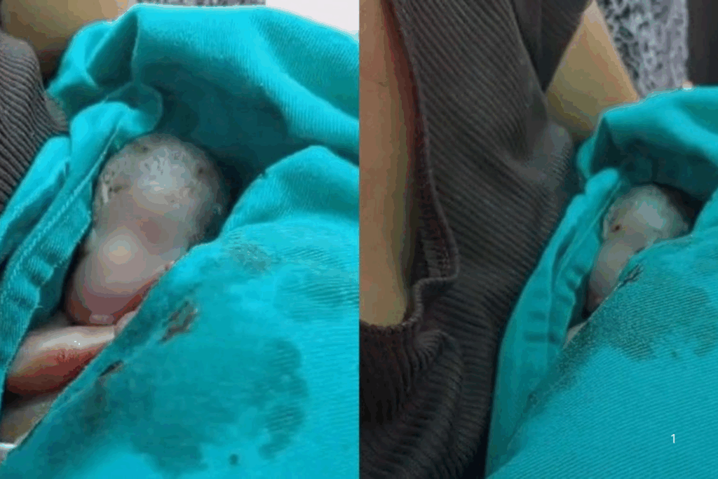 COMOÇÃO: Bebê Prematuro Resgatado Vivo no Próprio Velório não Resiste e Morre após Tratamento Intensivo