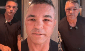 IRRECONHECÍVEL: Vitor Belfort Aparece com Rosto Inchado após Procedimento Estético