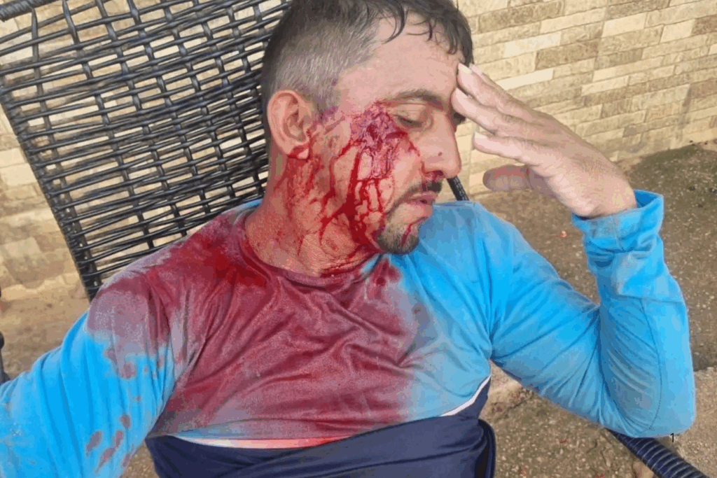 AGRESSÃO: Gari Foi Agredido ao Recusar Coleta de Vidro Perigoso em Rio Branco